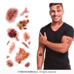 tatuajes-heridas-infectadas-30x13-cm-15918-8434077159187