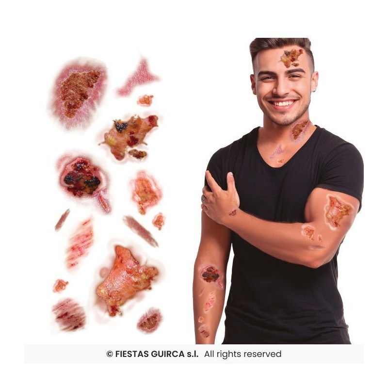 Tatuajes heridas infectadas 30x13 cm